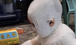 男婴在第三次手术前因走咖啡烧伤，“造成混乱”