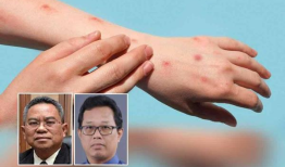 Mpox：一个日益增长的担忧，但不是大流行——卫生专家