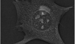全息层析显微镜允许研究人员量化新的细胞生物学现象