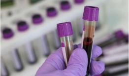 研究发现，血液蛋白可以预测60多种疾病的发病风险